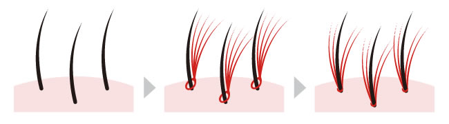 エクステ増毛イラスト図解